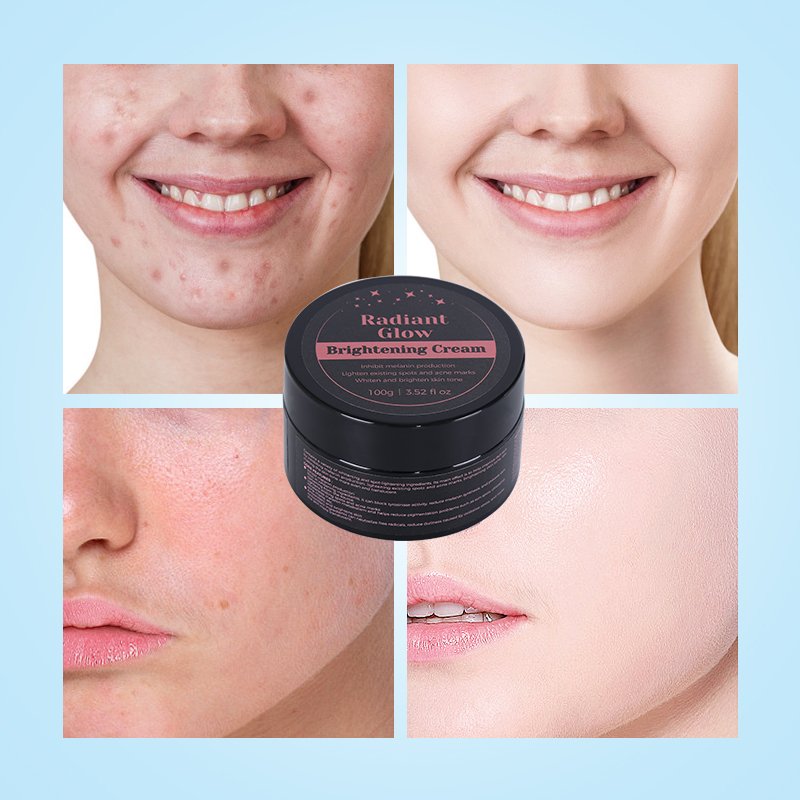 Skin Whitening Cream - 10